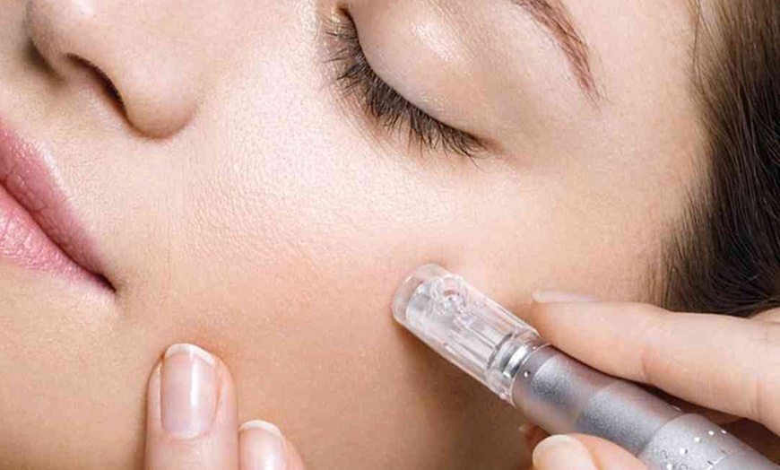 Image 1: 90 Min. Aqua-Facial & kosmetisches Microneedling für 1 Person