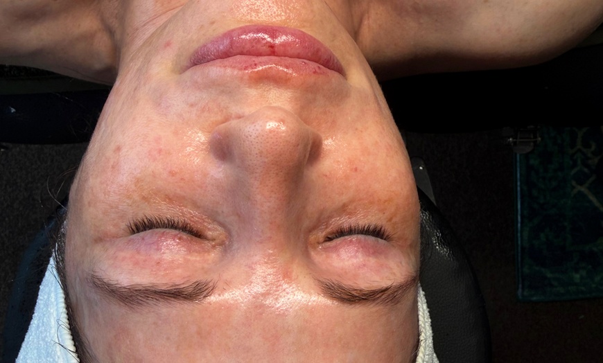 Image 2: HydraFacial: Deeply Cleanse, Exfoliate & Hydrate for Radiant Skin