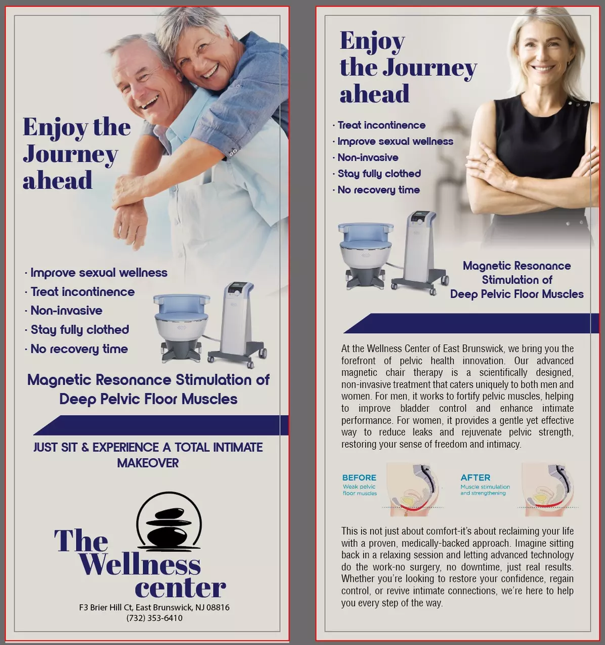 One, Two or Three Sessions of High-Intensity Electromagnetic Treatment