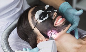Hollywood peeling con carbón activo y láser o limpieza facial prémium Hollywood peeling con carbón activo y láser o limpieza facial prémium