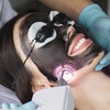 Image 2: Hollywood peeling con carbón activo y láser o limpieza facial prémium 