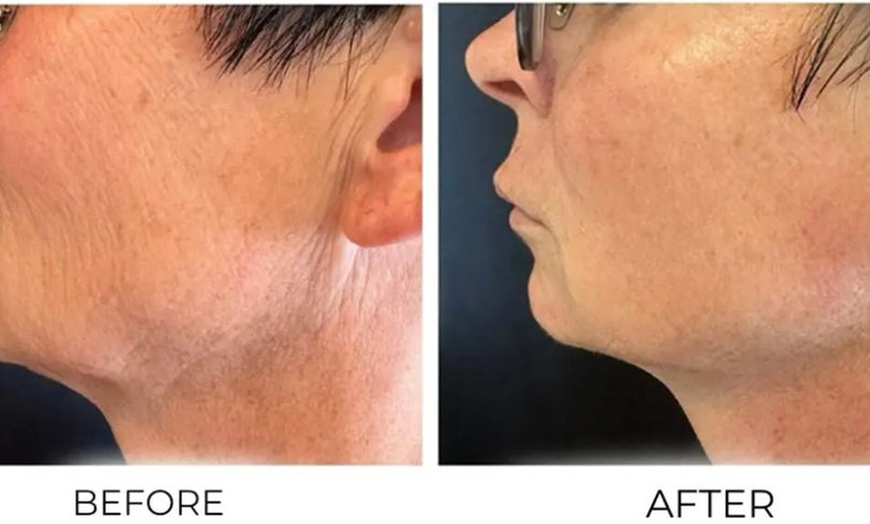 Image 8: Track Progress with 3D Body Scans and Body Sculpting Sessions