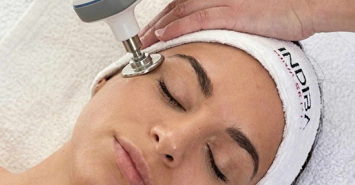 Sesión de radiofrecuencia facial Indiba y masaje kobido en Valencia