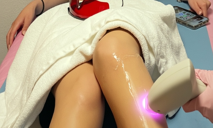 Image 2: 1, 3 o 5 sesiones de depilación con láser de diodo en zona a elegir