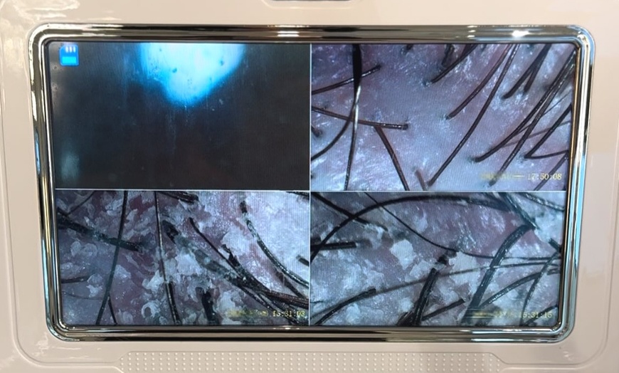 Image 6: Luxury Head Spa Treatments for 1 or 2 with Neck and Scalp Massage 