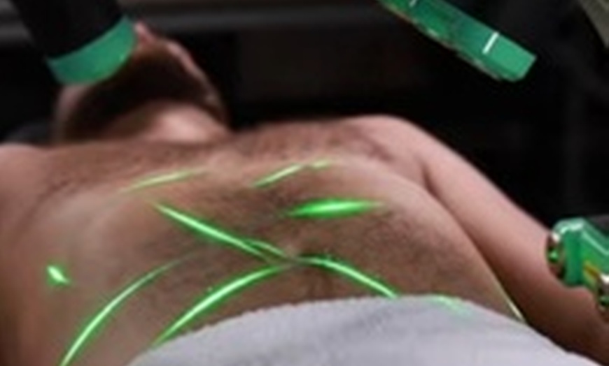 Image 4: Emerald Laser Fat Loss - Up To 4 inches Loss