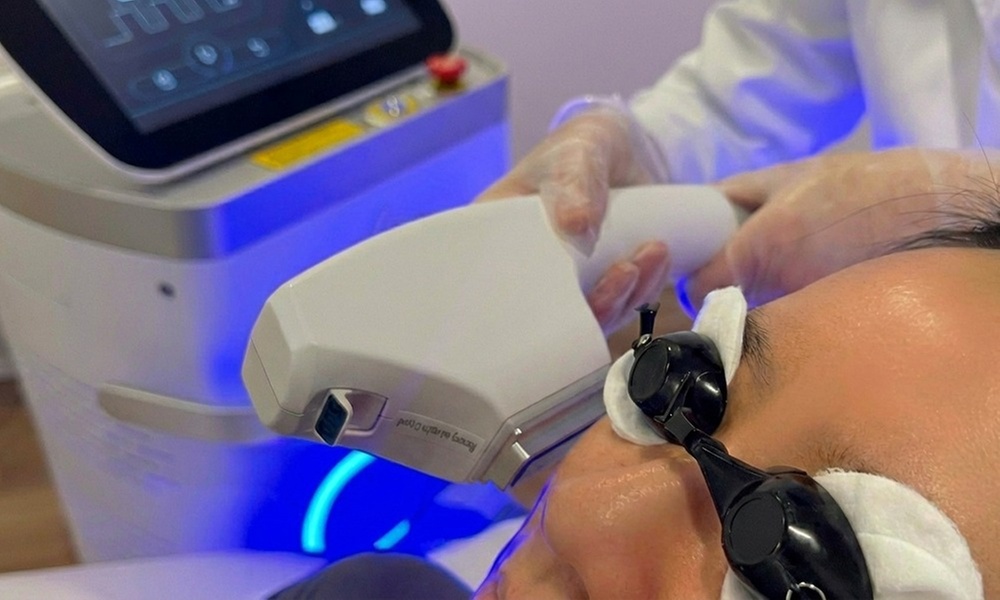 Revitalize w/ 1, 2 or 3 IPL Full Face Complexion Reset Session 30 Min