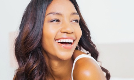 One teeth Whitening session - Laser by Nicole Lake Worth