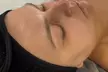 Glow Your Skin with One, Three or Five Oxygen Clarifying Facials at KP Aesthetics (Up to 73%Off) - Second Medium