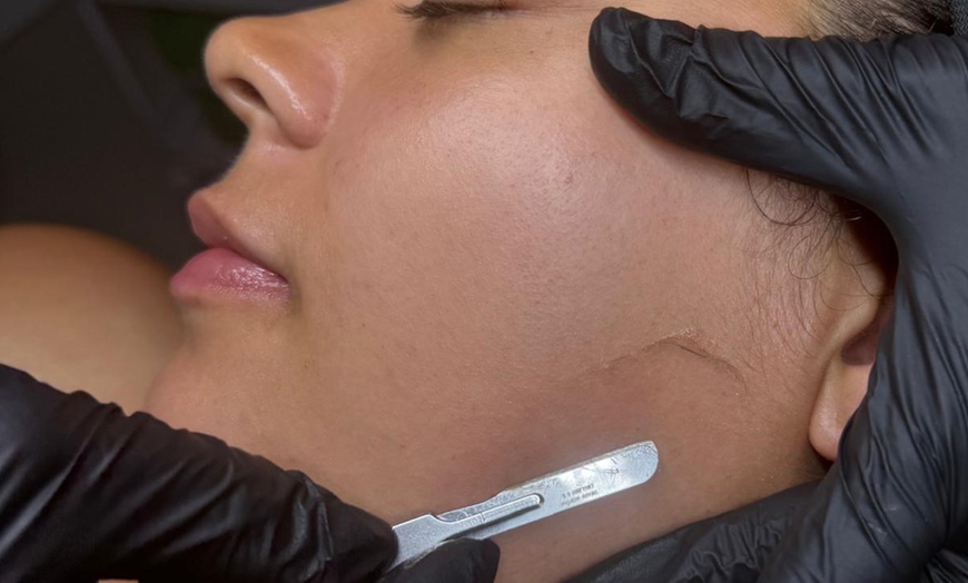 Image 5: Up to 47% Off on Facial - HydraFacial at Empress Skin Bromsgrove