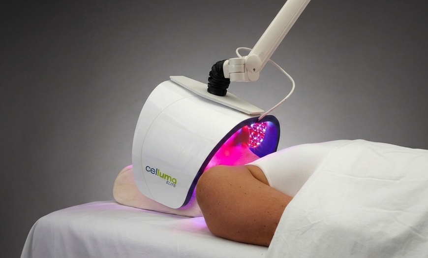 Image 3: Get One, Two, or Three 60 Minute Signature Facial with Smart Peel