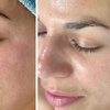 Image 10: Up to 55% Off on Facial - Chosen by Customer at Rise Skin Spa