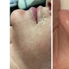 Image 6: One, Two, or Three 60-Minutes Belle Hydra Rejuvenation Sessions