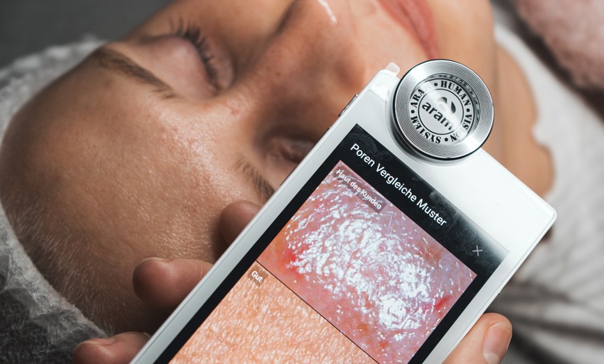 Image 9: Aquafacial mit Microdermabrasion oder Glowstart Gesichtsbehandlung