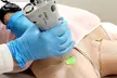 A-ONE Laser Clinic: Three Laser Hair Removal Sessions for Small, Medium or Large Area (Up To 75% Off) - Second Medium