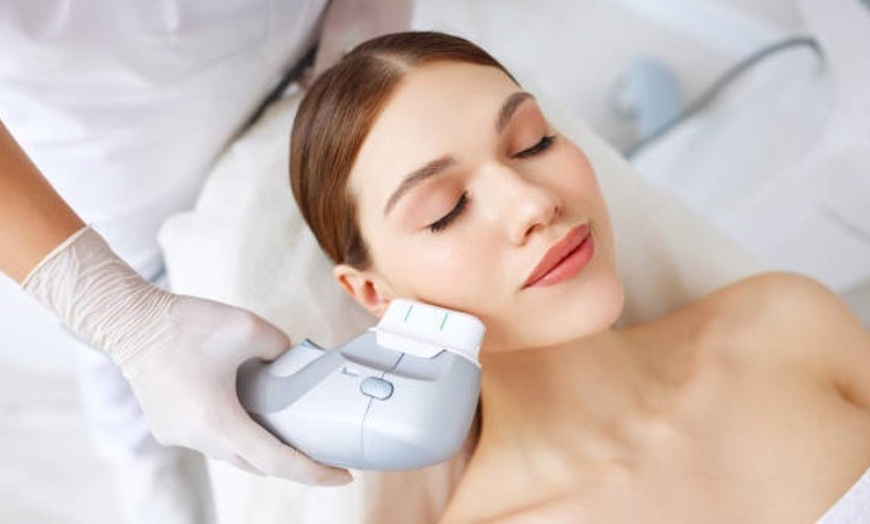 Image 7: HIFU 7D facial o corporal con zona a elegir o rostro completo y cuello