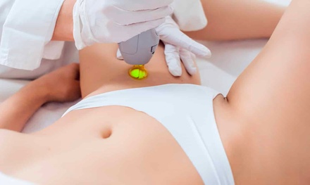 5 séances d'épilation laser : aisselles ou maillot classique - Golden Skin Paris