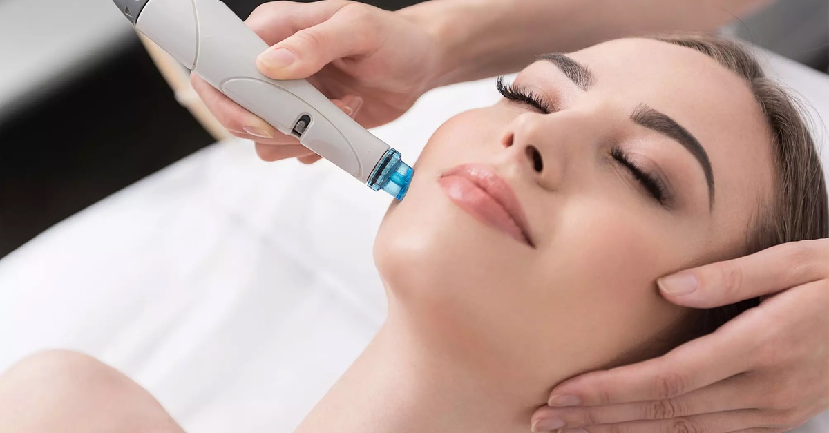 Tratamiento facial con exfoliación, peeling o dermapen en Valencia