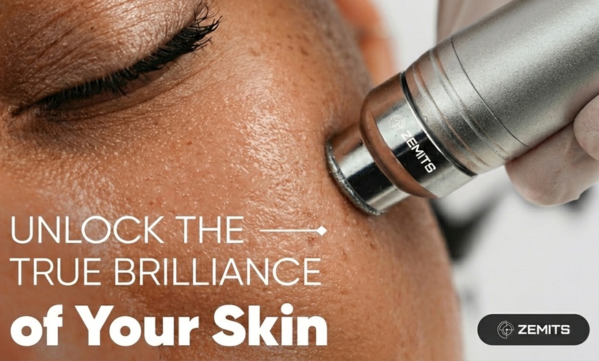 Image 3: One HydroDiamond™ Hydrodermabrasion with Optional Add-On LED Treatment