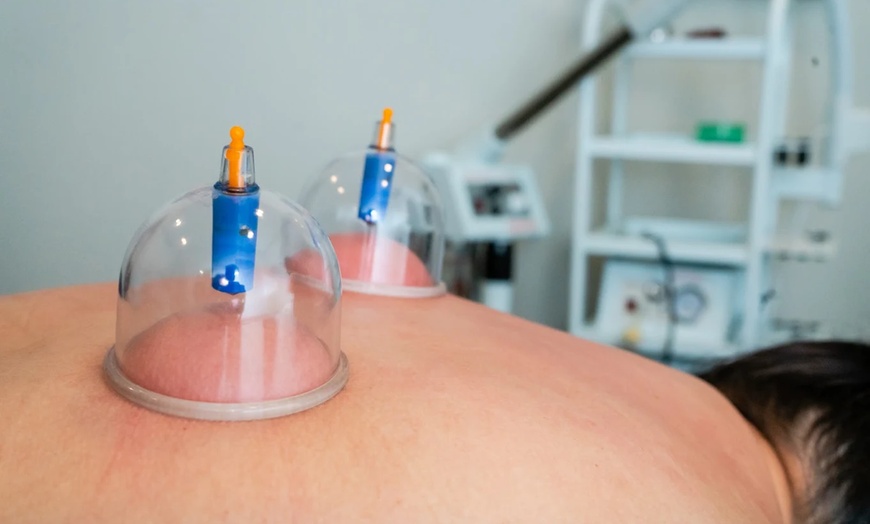 Image 5: Unwind with 60 or 90 Minute Therapeutic Massage with Cupping 