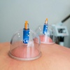 Image 5: Unwind with 60 or 90 Minute Therapeutic Massage with Cupping 