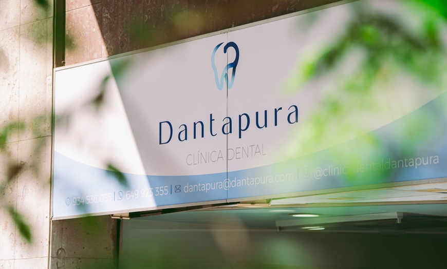 Image 5: Limpieza bucal con revisión y opción a blanqueamiento dental led