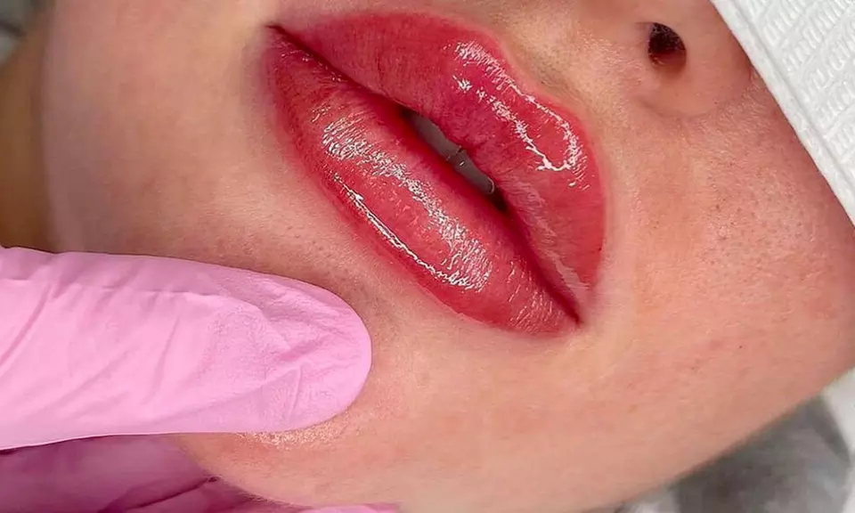 Even-Toned Beauty: Dark Lip Neutralization & Optional Enhancement