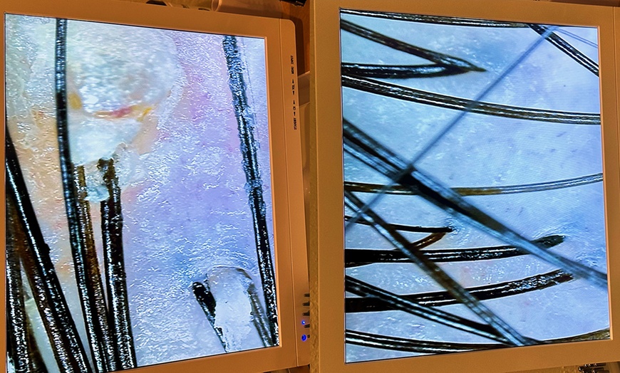 Image 6: Up to 55% Off on Salon - Scalp Care at LANA Hair Wash Spa