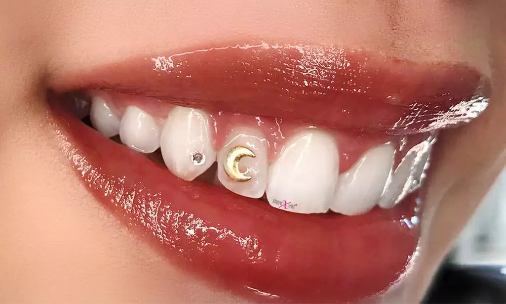 Stralende glimlach -met of zonder tooth gem-, onberispelijke make up, met korting tot 50% - Primary Image