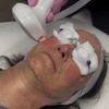 Image 3: Get Smooth Skin with IPL Lumecca Photo Facial Options