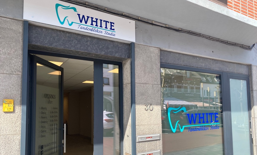 Image 2: Onthul je helderste smile met professionele tandenbleek behandeling