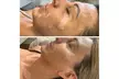 Skin Camouflage for Scars, Stretch Marks & Vitiligo (1–3 Sessions) at Skin De La Mer Miami (Up to 53% Off) - Second Medium