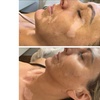 Image 2: Skin Camouflage for Scars, Stretch Marks & Vitiligo (1–3 Sessions)
