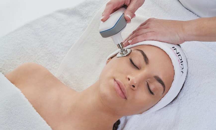 Image 1: 1 o 2 sesiones de radiofrecuencia Indiba facial o corporal