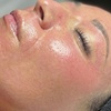 Image 3: 1, 2, or 3 Facials or Upgrade to Dermaplaning/Microdermabrasion