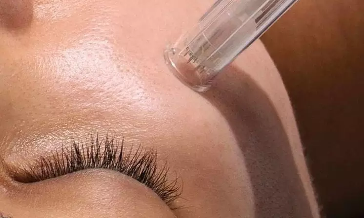 Chemical Peel, Dermaplanning Facial, Lip Blush Permanent Makeup & More