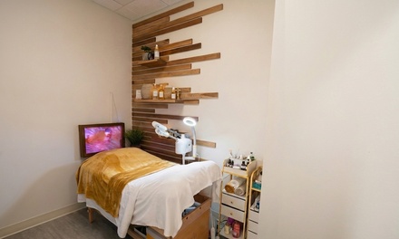 Five 60 Minute Microdermabrasion or Microchanneling Facial - Majestic Aesthetics by Jaki