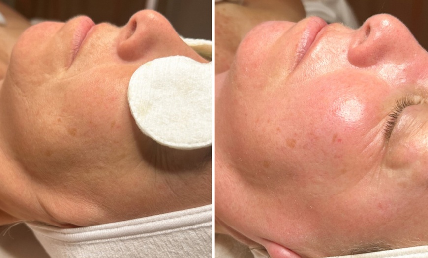 Image 5: Enjoy Lymphatic Facial Massage Treatment for Skin Rejuvenation