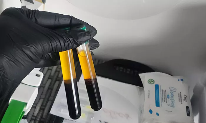 Enhance Yourself with PRP Skin and Hair Treatments