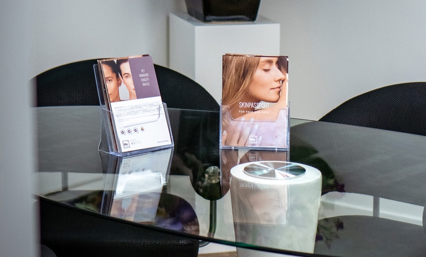 Image 7: Luxe Belotero Balance fillers met consultt voor een frisse uitstraling