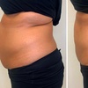 Image 2: Body Slimming & Wellness — Single, Multi-Session, or Monthly Pass 