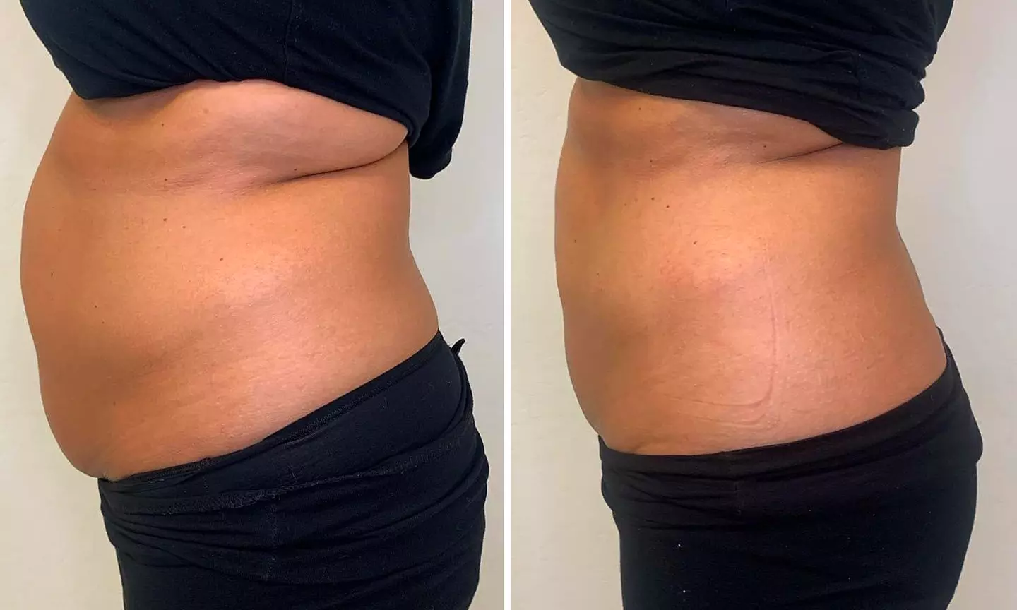 Body Slimming & Wellness — Single, Multi-Session, or Monthly Pass