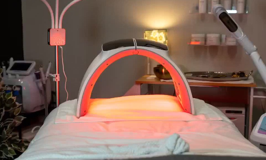 Image 4: One, Two or Three 45-Minute Scalp Massages