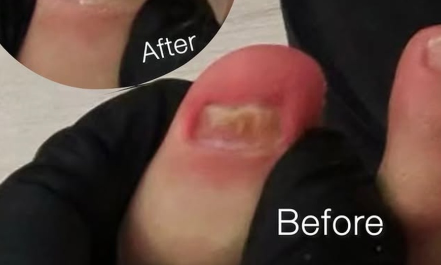 Image 5: Luxury Gel Manicure, Pedicure & Medi-Pedi Package 