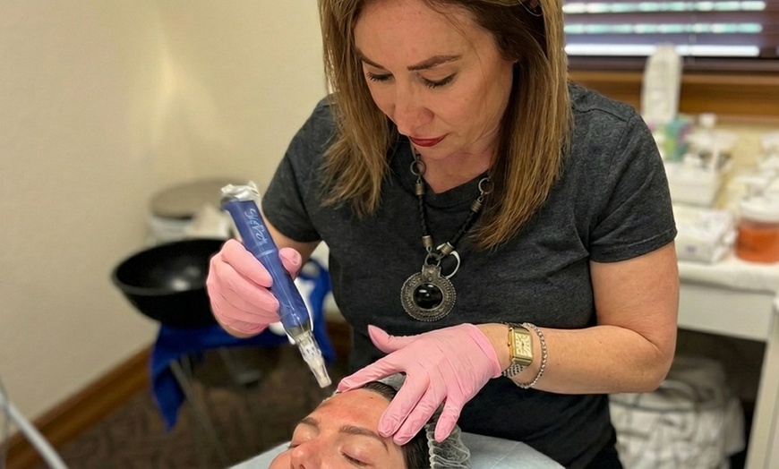 Image 2: Micro-Needling with PRP Facial for Smooth, Youthful Skin