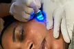 HydraFacial: The Ultimate Skin Refresh Experience and Save Up to 24% Off at Zahara Center - Second Medium