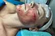 RC Holistic Hands Spa offers various PRP facial options, up to 83% off, for radiant skin - Second Medium