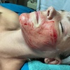 Image 2: Experience rejuvenation with PRP facial treatments