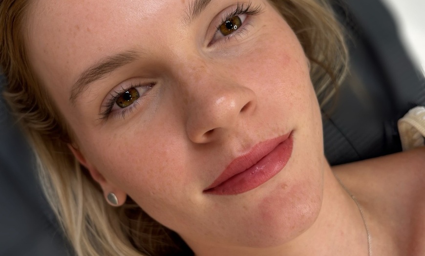 Image 11: Skin Needling & Pamper Packages for One or Two