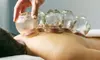 NO WAIT DOCTORS Offers One or Two Sessions of 60-Minutes Medical Cupping (Up to 20% Off)